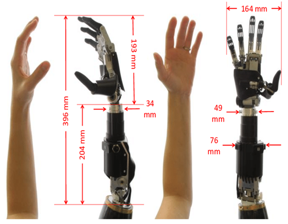 PROSTHETIC ARM